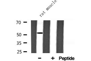 Western blot analysis of ARMC6 expression in Rat muscle lysate (ARMC6 anticorps  (C-Term))