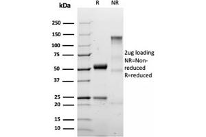 SDS-PAGE Analysis Purified S100B Recombinant Rabbit Monoclonal Antibody (S100B/1706R). (Recombinant S100B anticorps)