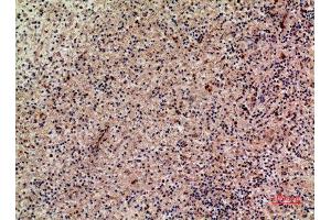 Immunohistochemistry (IHC) analysis of paraffin-embedded Human Liver, antibody was diluted at 1:100. (XCL1 anticorps  (Internal Region))