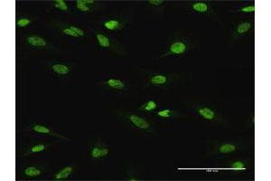 Immunofluorescence of purified MaxPab antibody to ATF1 on HeLa cell.