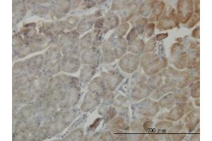 Immunoperoxidase of monoclonal antibody to RP6-213H19.