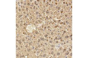 Immunohistochemistry of paraffin embedded mouse liver using Regucalcin (ABIN7075393) at dilution of 1:700 (300x lens) (Regucalcin anticorps)