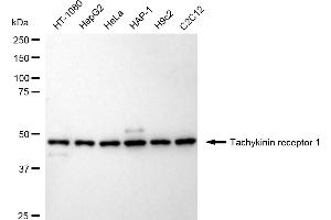 anti-Tachykinin Receptor 1 (TACR1) antibody