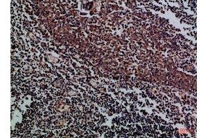 Immunohistochemical analysis of paraffin-embedded Human-tonsil, antibody was diluted at 1:100