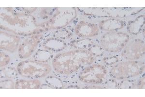 Detection of JAM2 in Human Kidney Tissue using Polyclonal Antibody to Junctional Adhesion Molecule 2 (JAM2)