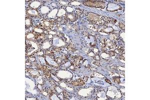 IHC analysis of SBP/SELENBP1 using anti-SBP/SELENBP1 antibody (ABIN7600755). (SELENBP1 anticorps  (AA 23-462))