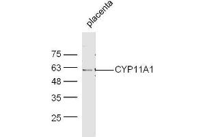 Mouse placenta lysates probed with Rabbit Anti-CYP11A1 Polyclonal Antibody, Unconjugated  at 1:500 for 90 min at 37˚C.