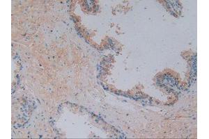 IHC-P analysis of Human Prostate Gland Tissue, with DAB staining. (Vitamin D-Binding Protein anticorps  (AA 209-401))