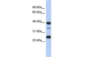 Image no. 1 for anti-Thymopoietin (TMPO) (N-Term) antibody (ABIN6743330) (Thymopoietin anticorps  (N-Term))