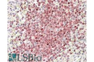 anti-POU Class 2 Associating Factor 1 (POU2AF1) (C-Term) antibody