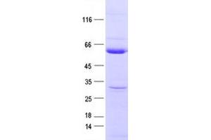 Validation with Western Blot