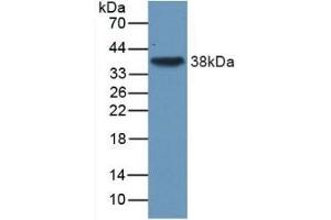 Detection of Recombinant TGFb3, Human using Monoclonal Antibody to Transforming Growth Factor Beta 3 (TGFb3) (TGFB3 anticorps  (AA 24-300))