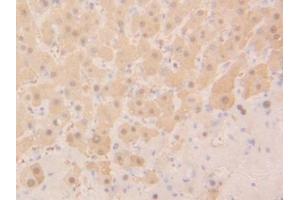 Detection of GSTa2 in Human Liver Tissue using Polyclonal Antibody to Glutathione S Transferase Alpha 2 (GSTa2)