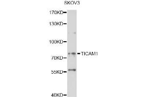 Western blot analysis of extracts of SKOV3 cells, using TICAM1 antibody (ABIN6292307) at 1:1000 dilution.
