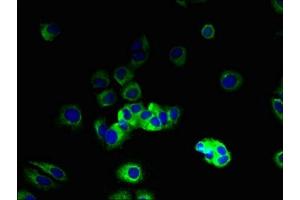 Immunofluorescent analysis of MCF-7 cells using ABIN7175630 at dilution of 1:100 and Alexa Fluor 488-congugated AffiniPure Goat Anti-Rabbit IgG(H+L)