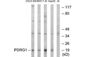 Western Blotting (WB) image for anti-P53 and DNA-Damage Regulated 1 (PDRG1) (AA 58-107) antibody (ABIN2890483) (PDRG1 anticorps  (AA 58-107))