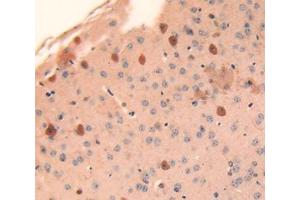 IHC-P analysis of brain tissue, with DAB staining. (Cathepsin L anticorps  (AA 18-113))