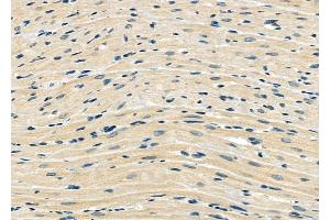 ABIN6265329 and ABIN6273169 at 1/100 staining Rat heart tissue by IHC-P. (STAU1/Staufen anticorps  (Internal Region))