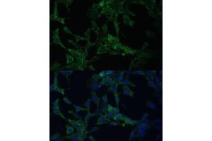 Immunofluorescence analysis of NIH-3T3 cells using CAMLG Polyclonal Antibody (ABIN6129359, ABIN6137896, ABIN6137897 and ABIN6217819) at dilution of 1:100 (40x lens).