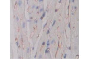 Figure. (TNFRSF10B anticorps  (AA 54-180))