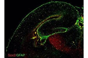 IHC-Fr Image GFAP antibodies detects GFAP proteins on embryonic mouse brain by immunohistochemical analysis. (GFAP anticorps)