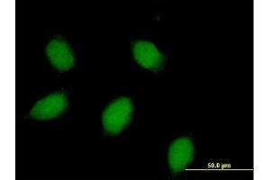 Immunofluorescence of purified MaxPab rabbit antibody to CALB1 on HeLa cell.