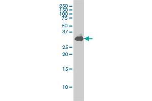 STX1A monoclonal antibody (M02), clone 1B11-1A8 Western Blot analysis of STX1A expression in IMR-32 .