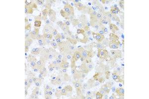 Immunohistochemistry of paraffin-embedded human liver injury using CETN1 antibody at dilution of 1:100 (x40 lens). (Centrin 1 anticorps)