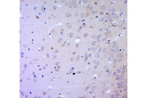 Paraformaldehyde-fixed, paraffin embedded mouse brain, Antigen retrieval by boiling in sodium citrate buffer (pH6.