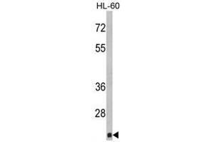Image no. 1 for anti-Core-Binding Factor, beta Subunit (CBFB) (Middle Region) antibody (ABIN452819) (CBFB anticorps  (Middle Region))