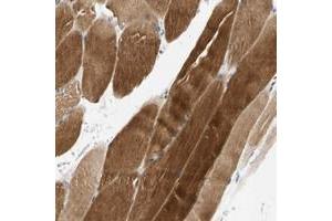 Immunohistochemical staining of human skeletal muscle with FAM198B polyclonal antibody  shows strong cytoplasmic positivity in myocytes. (FAM198B anticorps)