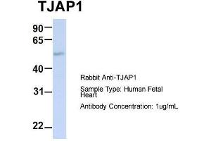 Host:  Rabbit  Target Name:  TJAP1  Sample Type:  Human Fetal Heart  Antibody Dilution:  1. (TJAP1 anticorps  (N-Term))