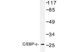 Image no. 1 for anti-CCAAT/enhancer Binding Protein (C/EBP), epsilon (CEBPE) antibody (ABIN272237) (CEBPE anticorps)