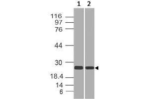 Image no. 1 for anti-RAP2A, Member of RAS Oncogene Family (RAP2A) antibody (ABIN5027782) (RAP2A anticorps)