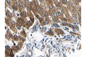 ABIN6266833 at 1/100 staining human liver tissue sections by IHC-P. (ARMCX3 anticorps  (N-Term))