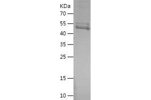 Western Blotting (WB) image for YTH Domain Family, Member 2 (YTHDF2) (AA 365-579) protein (His-IF2DI Tag) (ABIN7125761)