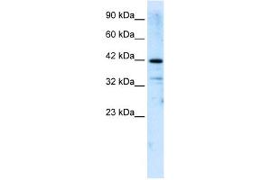 WB Suggested Anti-ZNF323 Antibody Titration:  2. (Zinc Finger and SCAN Domain Containing 31 (ZSCAN31) (Middle Region) anticorps)