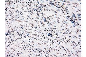 Image no. 12 for anti-Polo-Like Kinase 1 (PLK1) antibody (ABIN1500282)