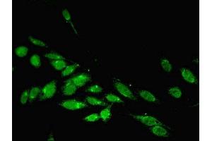 Immunofluorescent analysis of Hela cells using ABIN7163755 at dilution of 1:100 and Alexa Fluor 488-congugated AffiniPure Goat Anti-Rabbit IgG(H+L)