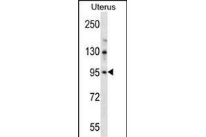LRRC37B Antibody (C-term) (ABIN657113 and ABIN2846260) western blot analysis in human normal Uterus tissue lysates (35 μg/lane). (LRRC37B anticorps  (C-Term))