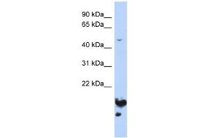 NUSAP1 antibody used at 1 ug/ml to detect target protein. (NUSAP1 anticorps  (Middle Region))