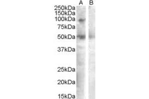 Western Blotting (WB) image for anti-Sulfatase 2 (SULF2) (AA 545-560) antibody (ABIN490407) (SULF2 anticorps  (AA 545-560))