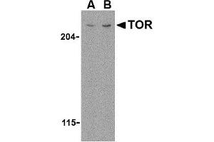 Western Blotting (WB) image for anti-RAR-Related Orphan Receptor C (RORC) (N-Term) antibody (ABIN1031636)