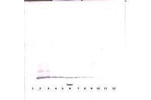 Image no. 4 for anti-Chemokine (C-C Motif) Ligand 8 (CCL8) antibody (ABIN465585) (CCL8 anticorps)