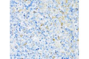 Immunohistochemistry of paraffin-embedded Rat spleen using VAMP1 Polyclonal Antibody at dilution of 1:100 (40x lens).