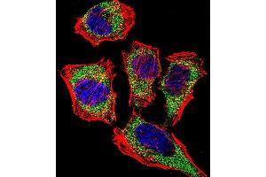 Fluorescent confocal image of Hela cell stained with CA2 Antibody (N-term) (ABIN652314 and ABIN2841442).