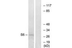 Western blot analysis of extracts from 293 cells, treated with serum 10% 15', using S6 Ribosomal Protein (Ab-235) Antibody. (RPS6 anticorps  (AA 196-245))