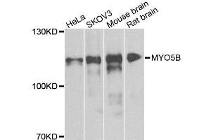 Western blot analysis of extracts of various cell lines, using MYO5B antibody. (MYO5B anticorps  (AA 1440-1690))