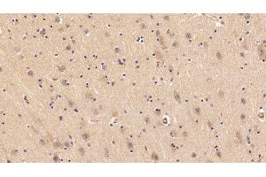 Detection of IGF1 in Porcine Cerebrum Tissue using Polyclonal Antibody to Insulin Like Growth Factor 1 (IGF1) (IGF1 anticorps  (AA 49-118))