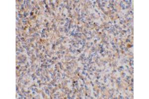 Immunohistochemical staining of human spleen tissue using AP30988PU-N at 2 μg/ml. (XAF1 anticorps  (C-Term))